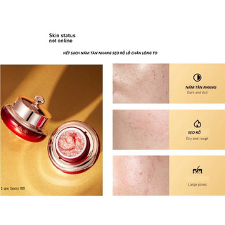 Kem dưỡng da dragon blood cream xóa nám mờ tàn nhang hiệu quả sau 28 ngày sử dụng