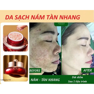 Kem dưỡng da dragon blood cream xóa nám mờ tàn nhang hiệu quả sau 28 ngày sử dụng