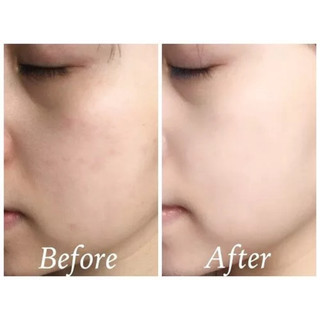 Mặt nạ bùn ủ trắng da mặt làm trắng bật tông da nhanh chóng chỉ sau 20 phút