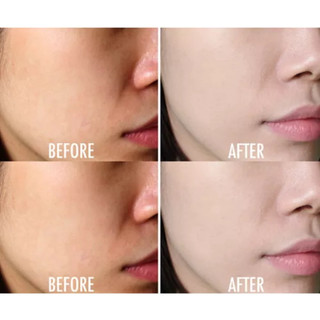 Mặt nạ bùn ủ trắng da mặt làm trắng bật tông da nhanh chóng chỉ sau 20 phút