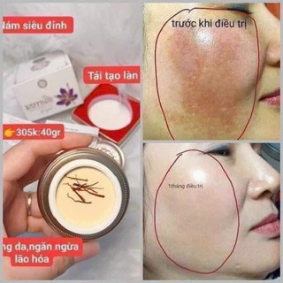 [CHÍNH HÃNG] Kem Nám Saffaron Giúp Tăng Sinh Collagen Mờ Thâm Nám Cho Làn Da Trẻ Trung Sáng Mịn