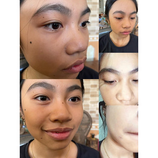 Tẩy Nốt Ruồi Tại Nhà Xoá Mụn Ruồi Tàn Nhang Mụn Thịt Dư lọ 8g