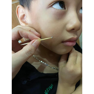 Tẩy Nốt Ruồi Tại Nhà Xoá Mụn Ruồi Tàn Nhang Mụn Thịt Dư lọ 8g