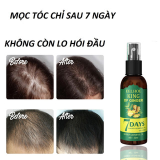 Xịt mọc tóc EELHOE tinh chất gừng tươi không chứa silicon kích thích mọc tóc sau 7 ngày 30ml