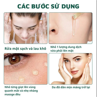 Serum dưỡng da Ouhoe xóa nhăn mở thâm nám ngăn ngừa da chảy xệ Anti Aging Daily 30ml
