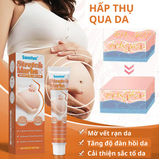 Kem làm mờ rạn da Sumifun giúp tái tạo làn da mờ sẹo giảm thâm giảm nhăn hiệu quả dành cho mẹ bầu 20g