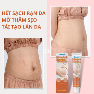 Kem làm mờ rạn da Sumifun giúp tái tạo làn da mờ sẹo giảm thâm giảm nhăn hiệu quả dành cho mẹ bầu 20g
