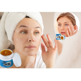 Kem bôi dưỡng da mắt Sumifun giúp giảm chứng đau nhức mỏi mắt giảm quầng thâm hiệu quả