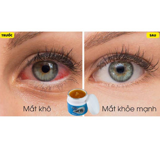 Kem bôi dưỡng da mắt Sumifun giúp giảm chứng đau nhức mỏi mắt giảm quầng thâm hiệu quả