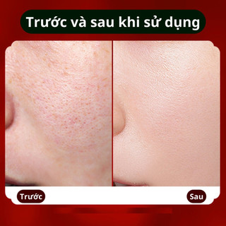 Kem dưỡng siêu cấp ẩm giúp làm trắng trẻ hóa căng mượt làn da ngăn ngừa thâm nám tan nhang 15g