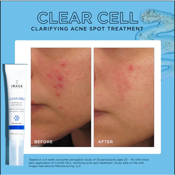 Ảnh Gel chấm mụn và giảm viêm cấp tốc IMAGE Skincare Clear Cell Clarifying Salicylic Blemish Gel 14g (new) 3