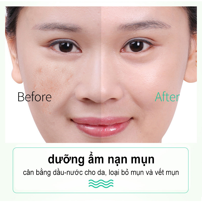 Gel Dưỡng Ẩm Chiết Xuất Lô Hội Soothing & Moisture Aloe Vera 92% Soothing Gel 40g được làm từ tinh chất Nha Đam tự nhiên