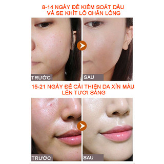 Serum sáng da mờ thâm nám Bioaqua vitamin C giúp đẹp căng bóng mịn màng ngăn ngừa lão hóa 30ml