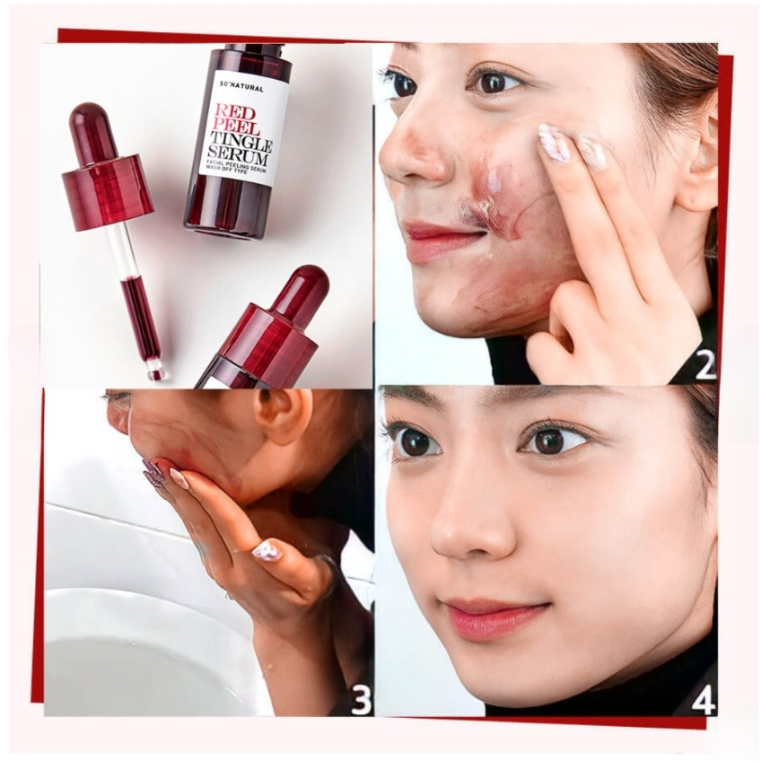 Peel da công nghệ sinh học Red Peel Tingle Serum 11ml (mẫu mới)