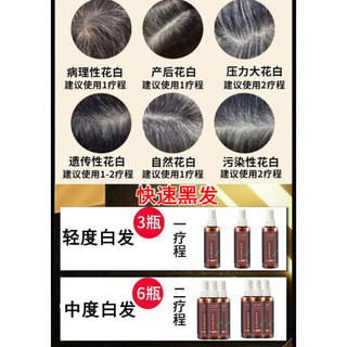 [HCM] TINH CHẤT THẢO DƯỢC XỊT ĐEN TÓC 100ml  Kẻ thù của tóc bạc trắng trở nên tóc đen.ngăn rụng tóc.phục hồi tóc hư tổn