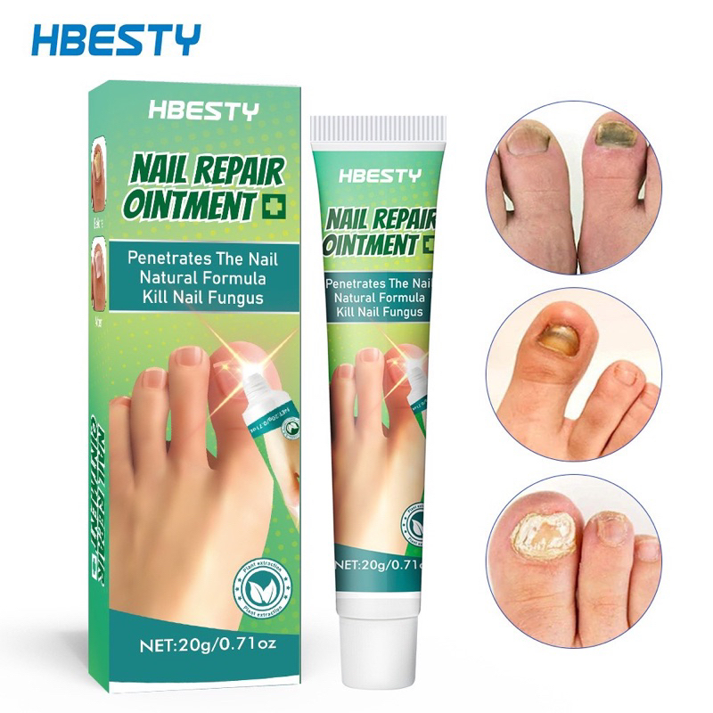 kem phục hồi móng,kích thích mọc móng và chống nấm 20ml