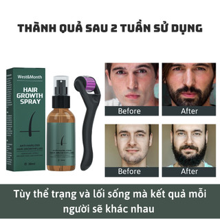 Tinh chất kích thích mọc râu quai nón West&Month giúp làm nhanh quá trình mọc râu cho nam giới 30ml