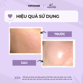 Mặt nạ lột mụn đầu đen toàn mặt TOPCHARM - Mặt nạ lột mụn đầu đen, thanh lọc và dưỡng da mịn màng