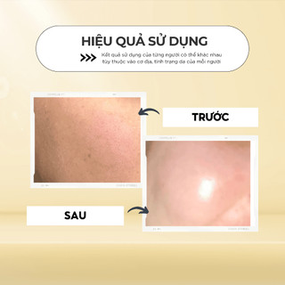 Mặt Nạ Bùn Lột Mụn TOPCHARMIS 30ml - Giúp Phục Hồi Da Khỏe Mạnh, Sạch Sâu Lỗ Chân Lông
