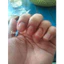Serum đánh bay nấm móng, hư khoé, bọng móng, nước ăn tay chân gia truyền Lọ 4ml