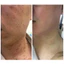 Cao Xoá Sẹo Collagen Mờ Sẹo Lồi Lõm Giúp Nhanh Lành Vết Thương Không Để Lại Sẹo Hủ Net 10gr