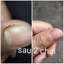 Serum đánh bay nấm móng, hư khoé, bọng móng, nước ăn tay chân gia truyền Lọ 4ml