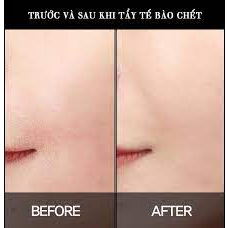 𝗧𝗮̂̉𝘆 𝗱𝗮 𝗰𝗵𝗲̂́𝘁 𝗯𝗼𝗱𝘆 đ𝗮̀𝗼 chính hãng