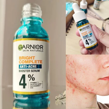 Tinh Chất Garnier Giảm Mụn Mờ Thâm Cho Da Dầu, Mụn
