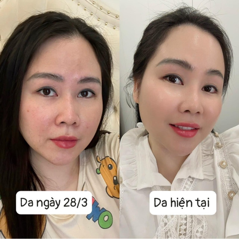 Kem dưỡng trắng da, nâng tông, làm đều màu da, cấp ẩm YOUDI 30gam
