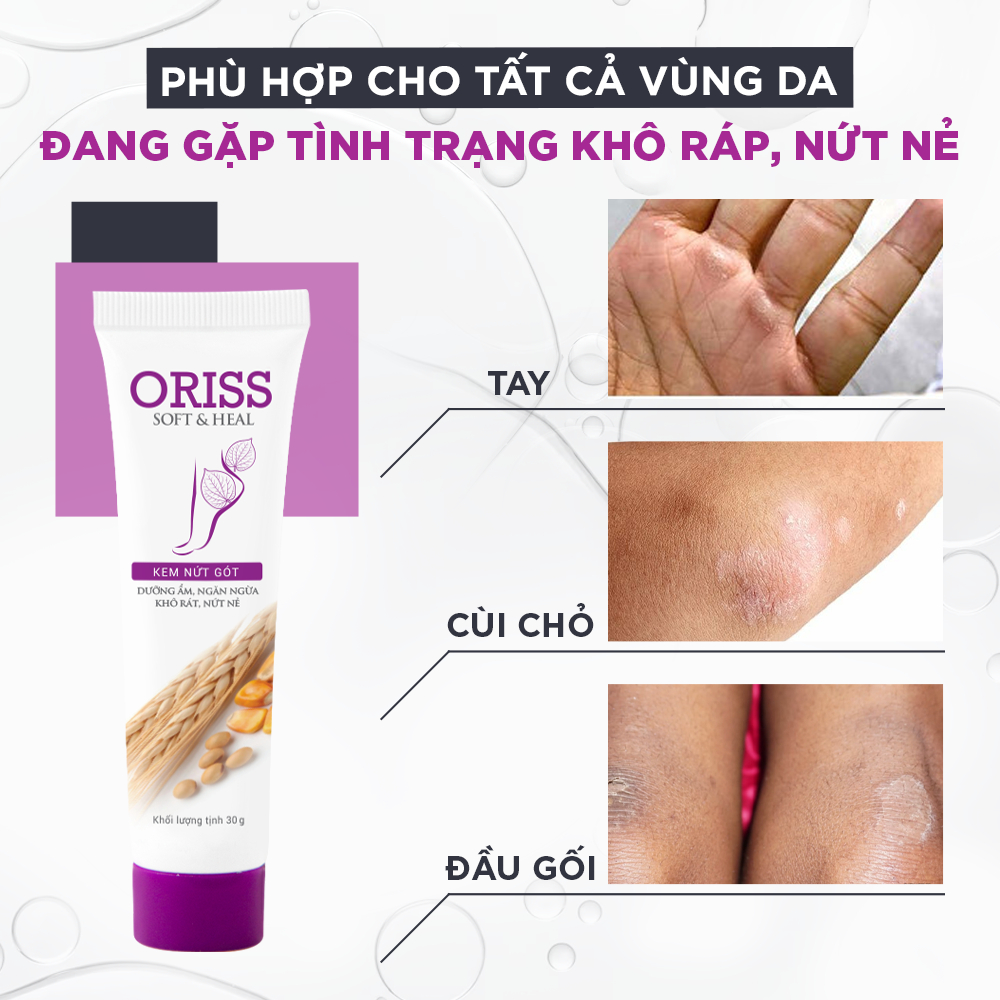 Kem nứt gót và dưỡng da chân tay Oriss tinh chất nghệ và trầu không tái tạo làm hồng gót Tuýp 30gr