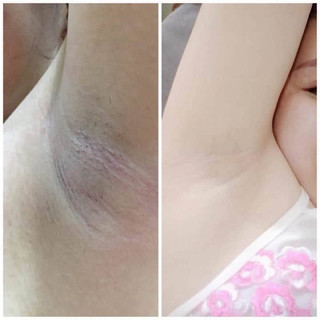 [Combo 2 Hộp] Kem Khử Thâm Nách Hôi Nách Gluta Milk Thái Lan (mua 1 tặng 1) VIP White