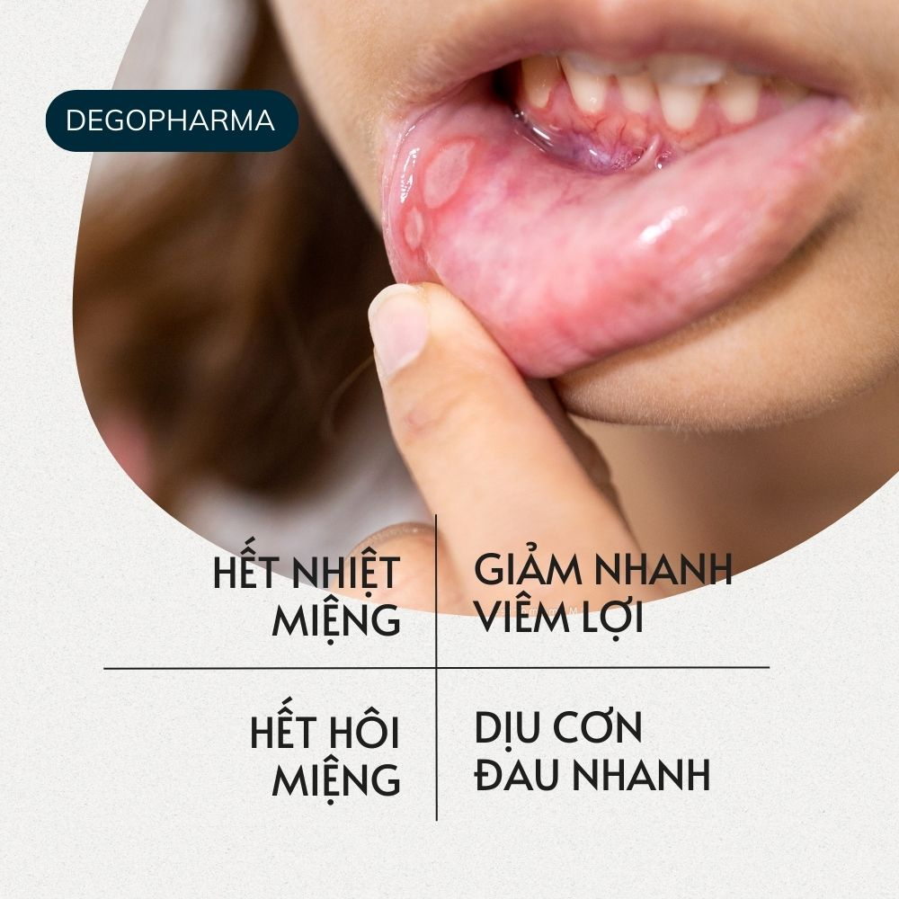 Ảnh Xịt Dứt Điểm Nhiệt Miệng, Nhiệt lưỡi, Lở môi, Viêm Lợi Dego Pharma - Dịu Cơn Đau Loét Miệng, Hết Hôi Miệng 4