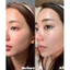SERUM CẤP NƯỚC TORRIDEN DIVE IN