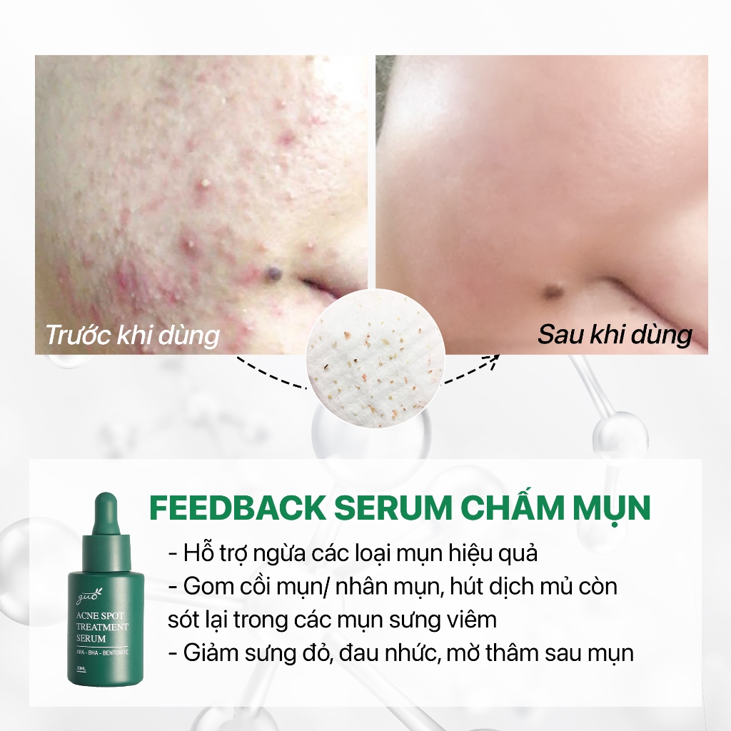 Ảnh Serum giảm mụn, mờ thâm BHA 1%+AHA 2%+tràm trà, giảm sợi bã nhờn hiệu quả GUO 30ml 4