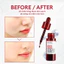 Tinh Chất Tái Tạo Da So’ Natural Red Peel Tingle Serum (35ml)