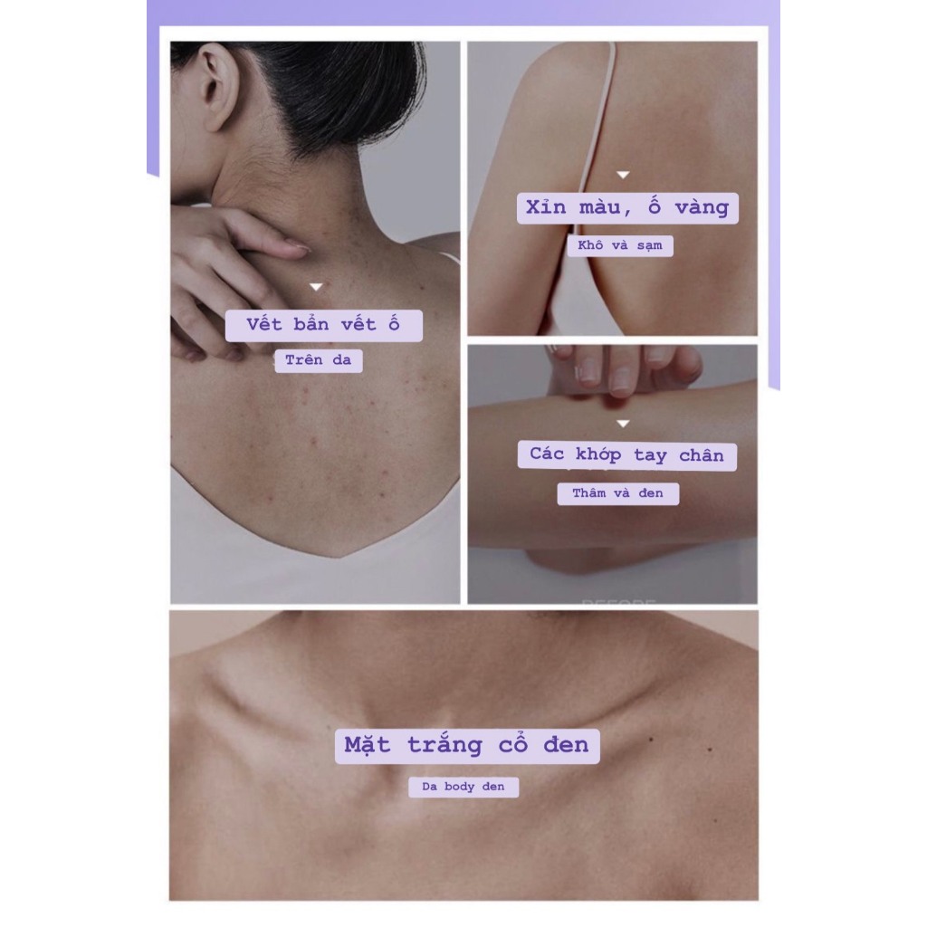 [GIÁ SỐC] Mặt Nạ Ủ Trắng Body YINBA 150ml Giúp Da Mềm Mịn Trắng Sáng Hàng Chuẩn Nội Địa UTBD01