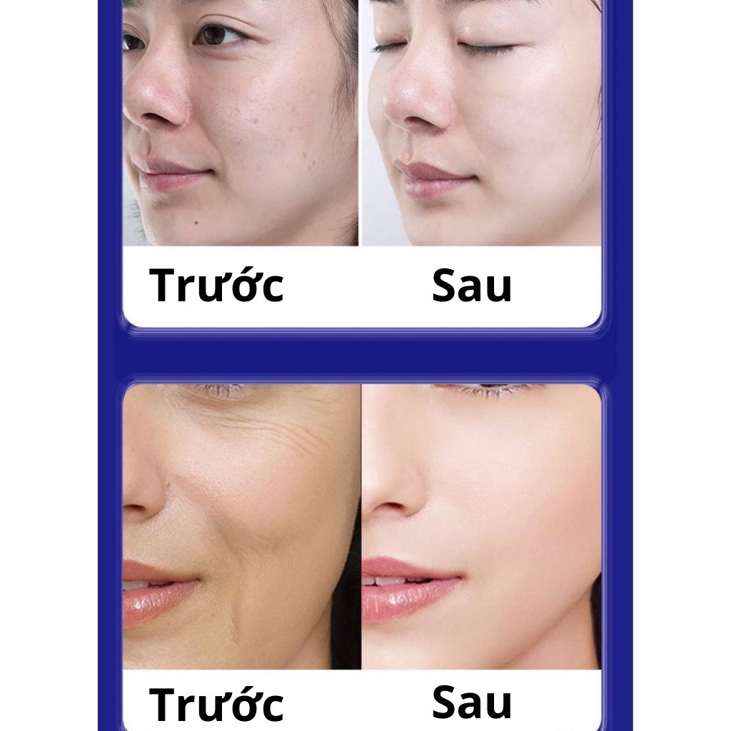 Kem Giảm Nám Tàn Nhang Và Trẻ Hóa Làn Da UCM Nội Địa Nhật dễ dùng, hiệu quả cao KGN01