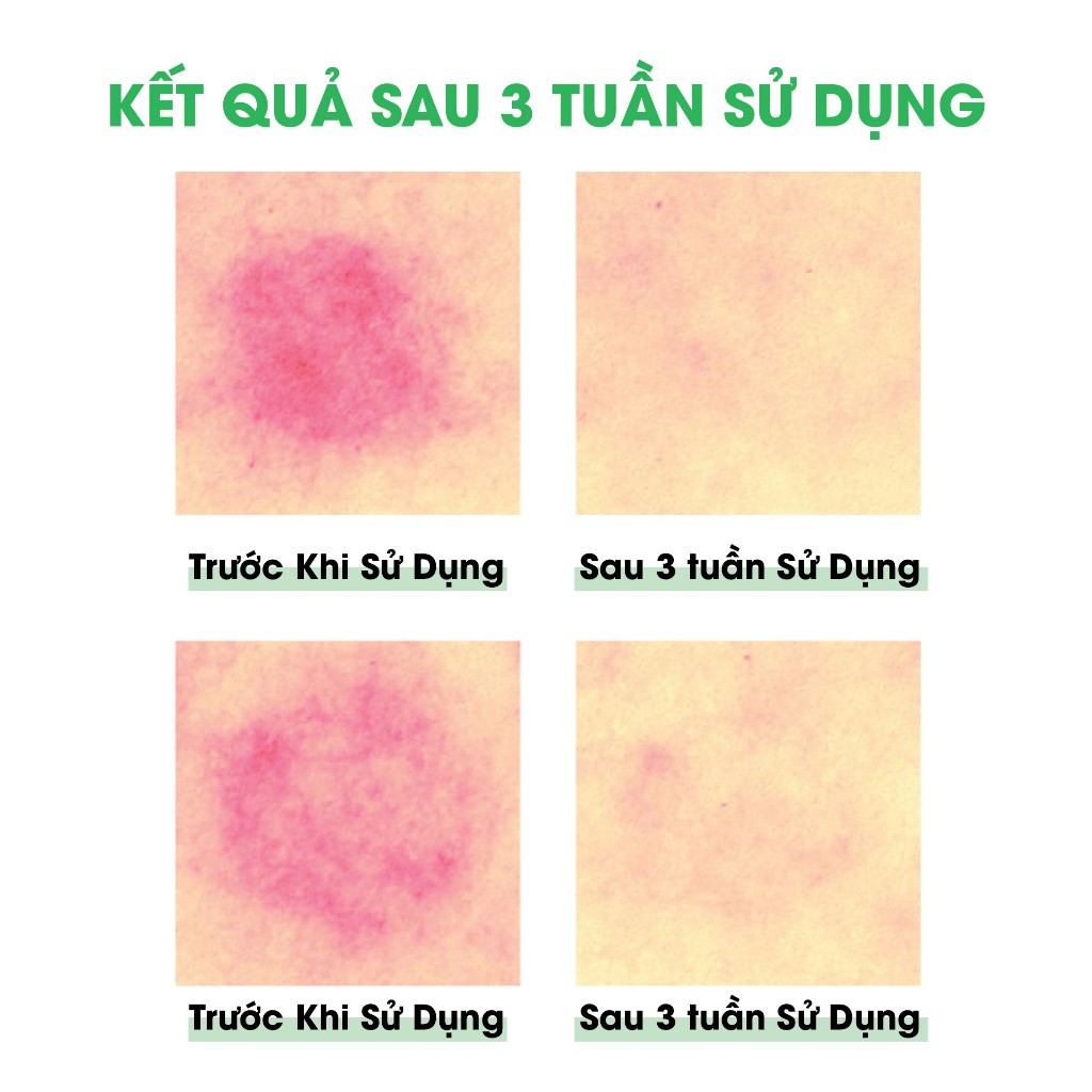 Ảnh Tinh Chất Rau Má Cấp Ẩm Làm Dịu Da Ample:N Centel Calming Shot Ampoule 4