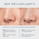 Máy rửa mặt FOREO LUNA 4 cao cấp được chứng minh lầm sàng làm sạch sâu mát-xa trẻ hoá da bằng sóng âm T-sonic phiên bản cho da thường — ảnh 6