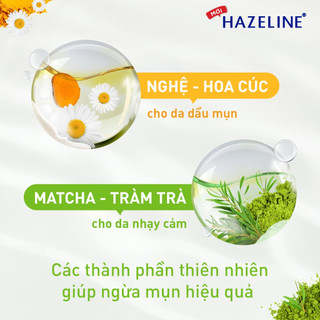 Sữa & Gel Rửa Mặt Hazeline Ngừa Mụn- Làm Sạch -Dịu Nhẹ Cho Da Sáng Rạng Ngời 100g