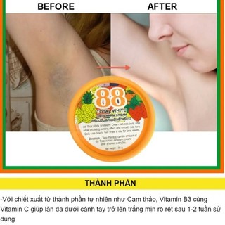 KEM TRẮNG NÁCH 88 TOTAL WHITE UNDERARM CREAM 35G THÁI LAN