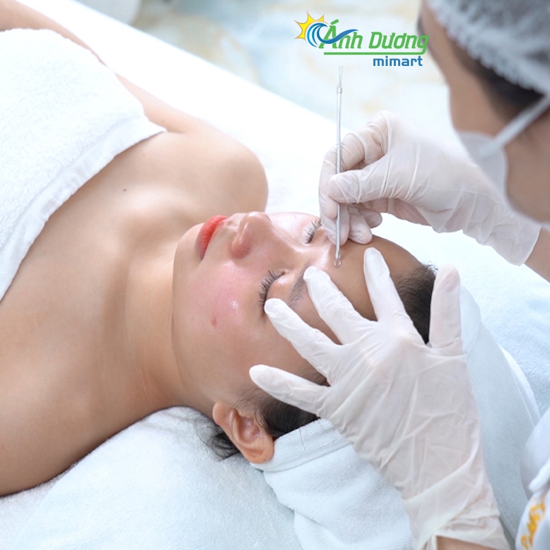 Que nặn mụn trứng cá đã tiệt trùng vi khuẩn