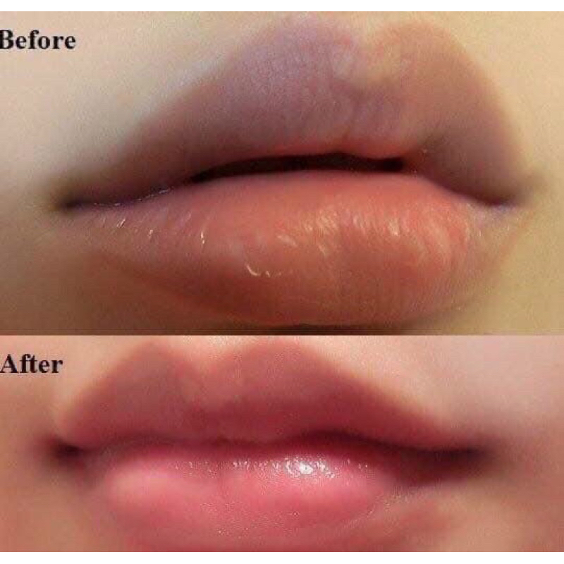 SON KEM DƯỠNG MÔI COLLAGEN CÓ MÀU DÙNG ĐƯỢC CHO BÀ BẦU GIÚP GIẢM THÂM MÔI KÍCH MÀU SAU PHUN XĂM 2024