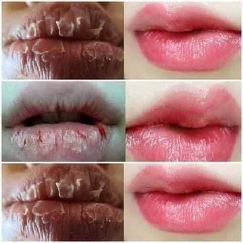 SON KEM DƯỠNG MÔI COLLAGEN CÓ MÀU DÙNG ĐƯỢC CHO BÀ BẦU GIÚP GIẢM THÂM MÔI KÍCH MÀU SAU PHUN XĂM 2024