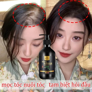 Dầu gội mọc tóc dầu gội đen tóc dầu gội gừng 300ml dầu gội thảo dược Kiểm soát dầu Loại bỏ gàu Giảm rụng tóc