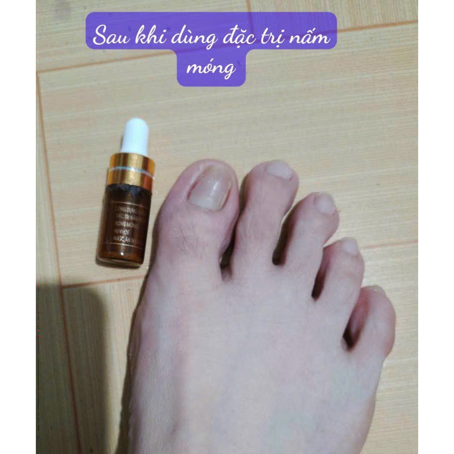 Combo 1 serum và 1 dưỡng móng đánh bay nấm móng, hư khóe, bọng móng và giúp móng nhanh dài cứng cáp (hũ 8gr, lọ 4ml)