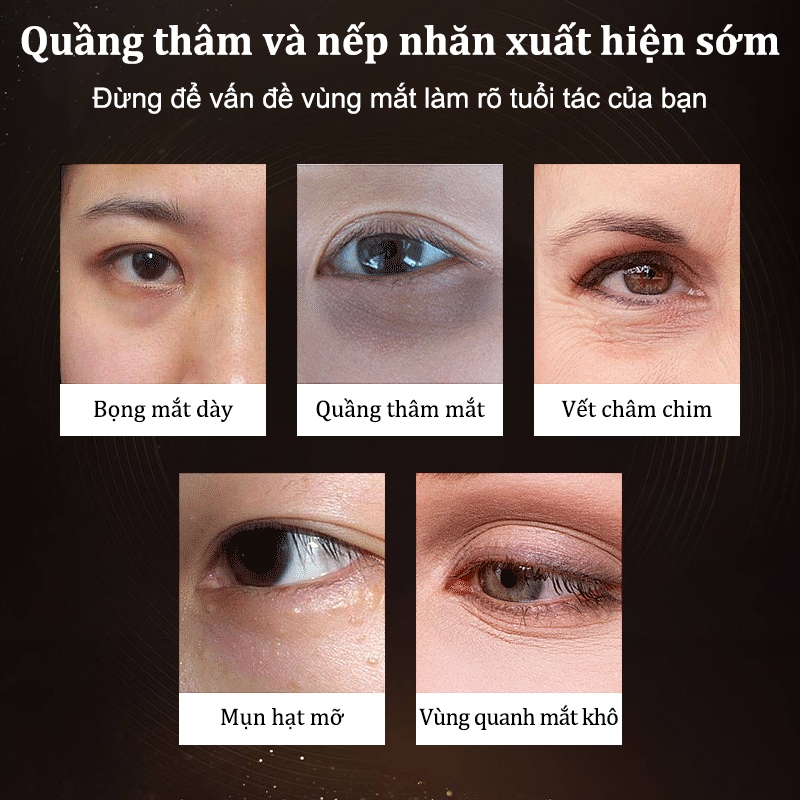 Sử dụng Kem Dưỡng Mắt Giảm Thâm & Nếp Nhăn trong đời sống