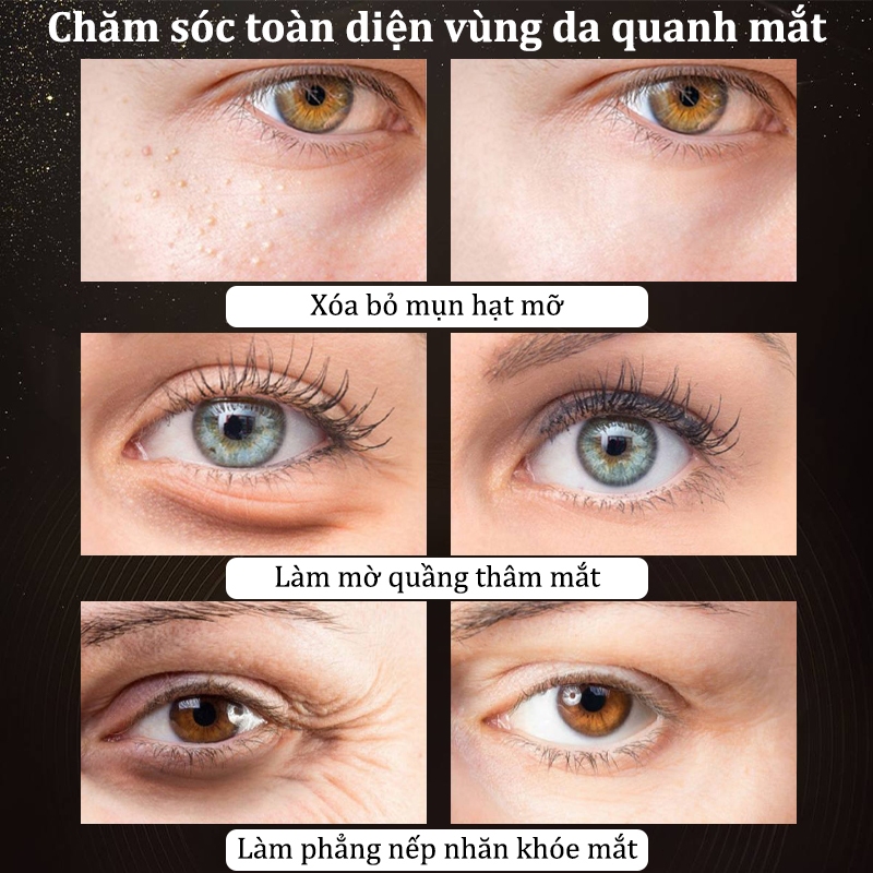 Kem Dưỡng Mắt Giảm Thâm Nếp Nhăn - Kem dưỡng mắt Kem mắt chống lão hó kem giảm thâmắt Loại bỏ mụn hạt mỡ Làmờ nế...