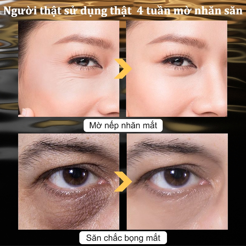 Chất lượng Kem Dưỡng Mắt Giảm Thâm & Nếp Nhăn