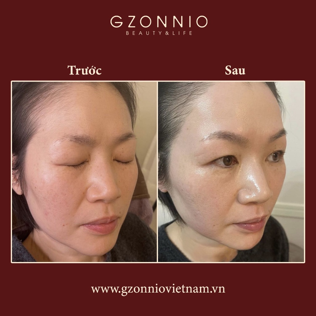 Treatment Serum